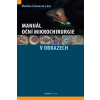 Manuál oční mikrochirurgie v obrazech - Zemanová Markéta a kolektiv Manuál oční mikrochirurgie v obrazech - Zemanová Markéta a kolektiv