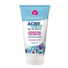 Dermacol Acneclear Face Wash Gel 150 ml Dermacol Acneclear Face Wash Gel 150 ml