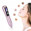 IPL laser 11317 IPL laser 11317