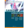 Sarkomy měkkých tkání - Lischke Robert, Malinová Běla, Ozaniak Andrej, kol Sarkomy měkkých tkání - Lischke Robert, Malinová Běla, Ozaniak Andrej, kol