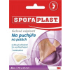 3M SPOFAPLAST č.912 Gélové náplasti na pľuzgiere na pätách, 70x45 mm, 4 ks 3M SPOFAPLAST č.912 Gélové náplasti na pľuzgiere na pätách, 70x45 mm, 4 ks