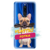 Silikonové pouzdro s vlastní fotkou pro Xiaomi Redmi 8 - iSaprio (Odolný silikonový kryt, obal, pouzdro s vlastním motivem / potiskem na mobil Xiaomi Redmi 8 - skvělá ochrana a pružnost, stylový UV po Silikonové pouzdro s vlastní fotkou pro Xiaomi Redmi 8 - iSaprio (Odolný silikonový kryt, obal, pouzdro s vlastním motivem / potiskem na mobil Xiaomi Redmi 8 - skvělá ochrana a pružnost, stylový UV po