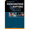 Poinfarktová ruptura - Petr Kačer Poinfarktová ruptura - Petr Kačer
