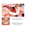 Kozmetická zubná náhrada Beauty Smile – silikónový prekryv na horné/dolné zuby, umelý zubný mostík Kozmetická zubná náhrada Beauty Smile – silikónový prekryv na horné/dolné zuby, umelý zubný mostík