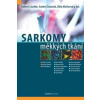 Sarkomy měkkých tkání - Robert Lischke, Andrej Ozaniak, Běla Malinová Sarkomy měkkých tkání - Robert Lischke, Andrej Ozaniak, Běla Malinová