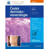 Česká dermatovenerologie 2021/3 Třešňák Hercogová Jana 2021 (E-kniha) Česká dermatovenerologie 2021/3 Třešňák Hercogová Jana 2021 (E-kniha)