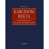 Karcinom rekta od diagnózy po multidisciplinární léčbu (Peter Ihnát ) Karcinom rekta od diagnózy po multidisciplinární léčbu (Peter Ihnát )
