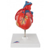 Klasické srdce s obtokom, 2 časti (Anatomické modely) Klasické srdce s obtokom, 2 časti (Anatomické modely)