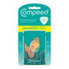 Johnson & Johnson Consumer France S.A.S. Compeed NÁPLASŤ na mozole stredná, gélova, 1x6 ks Johnson & Johnson Consumer France S.A.S. Compeed NÁPLASŤ na mozole stredná, gélova, 1x6 ks