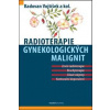 Radioterapie gynekologických malignit - Radovan Vojtíšek Radioterapie gynekologických malignit - Radovan Vojtíšek