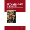 Revmatologie v kostce - Marta Olejárová Revmatologie v kostce - Marta Olejárová