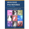 Spontánní pneumotorax - Josef Vodička a kolektiv Spontánní pneumotorax - Josef Vodička a kolektiv