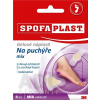 3M SPOFAPLAST č.913 Gélové náplasti na pľuzgiere, mix veľkostí a tvarov, 1x5 ks 3M SPOFAPLAST č.913 Gélové náplasti na pľuzgiere, mix veľkostí a tvarov, 1x5 ks