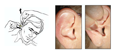 Jak správně vybrat špunty do uší?
