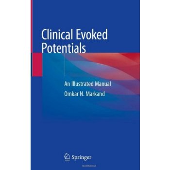 Clinical Evoked Potentials : An Illustrated Manual