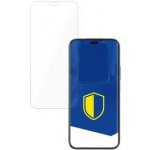 3mk FlexibleGlass pro Honor X8B 5903108569293 – Zboží Živě