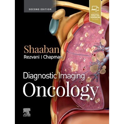 Diagnostic Imaging: Oncology Shaaban Akram M. Professor of Radiology Department of Radiology and Imaging Sciences University of Utah School of Medicine Salt Lake City UtahPevná vazba – Hledejceny.cz