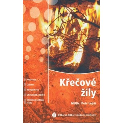 Křečové žíly – Zbozi.Blesk.cz