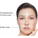 SkinRémide silikonové polštářky na vrásky kolem úst a v čele 160 ks – Zboží Dáma