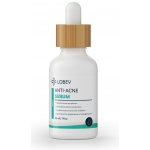 LOBEY® Classic Sérum na akné na obličeji 30 ml – Hledejceny.cz