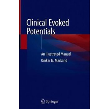 Clinical Evoked Potentials : An Illustrated Manual