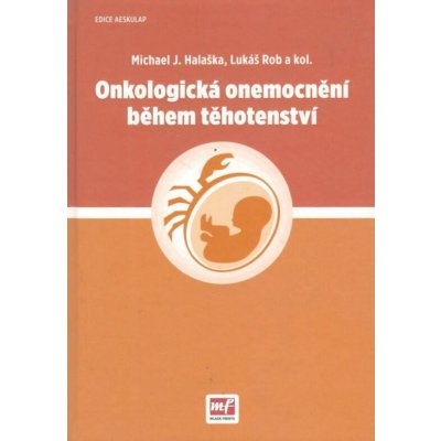 Onkologická onemocnění během těhotenství - Lukáš Rob, Michael J. Halaška, kol.