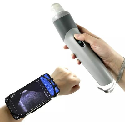 Ultrazvukový scanner W3 bezdrátový s abdominální sondou – Zboží Dáma