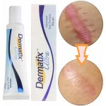 Dermatix Ultra Silikonový Gel 15 g – Hledejceny.cz