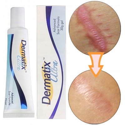 Dermatix Ultra Silikonový Gel 15 g – Hledejceny.cz