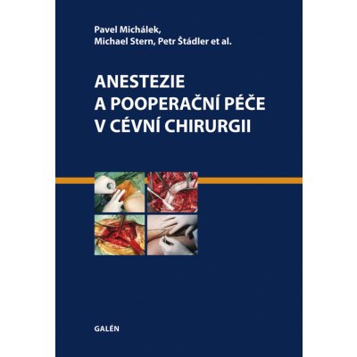 Anestezie a pooperační péče v cévní chirurgii – Hledejceny.cz