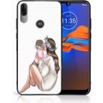 Pouzdro PROTEMIO 45260 MY ART Silikonový obal Motorola Moto E6 Plus BABY GIRL (111) – Zbozi.Blesk.cz