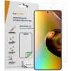 Ochranná fólie pro mobilní telefon Ochranná fólie kwmobile Xiaomi Redmi Note 13 Pro 5G / Poco X6 5G, 3ks