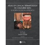 Atlas of Clinical Dermatology in Coloured Skin – Hledejceny.cz