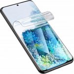 Ochranná fólie Hydrogel Xiaomi Redmi Note 9 Pro 5G – Zboží Mobilmania