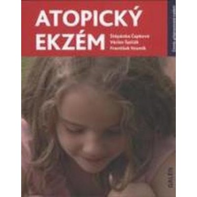 Atopický ekzém Štěpánka Čapková – Zbozi.Blesk.cz