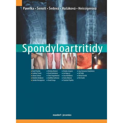 Spondyloartritidy - Karel Pavelka; Ladislav Šenolt; Liliana Šedová