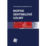 Biopsie sentinelové uzliny – Hledejceny.cz
