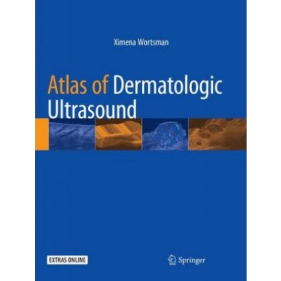 Atlas of Dermatologic Ultrasound – Zbozi.Blesk.cz