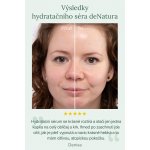 deNatura hydratační sérum s kyselinou Hyaluronovou a vitamínem C 50 ml – Zboží Mobilmania