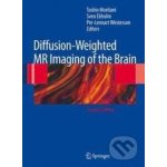 Diffusion-Weighted MR Imaging of the Brain - Toshio Moritani, Sven Ekholm, Per-Lennart A. Westesson – Hledejceny.cz