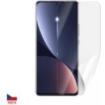 Ochranná fólie ScreenShield XIAOMI 12X 5G - displej – Zboží Živě