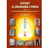 Kniha Otoky a záhadná lymfa aneb pravé příčiny celulitidy, obezity a neúspěšných pokusů zhubnout - Jitka Bičíková