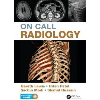 On Call Radiology - Lewis Gareth