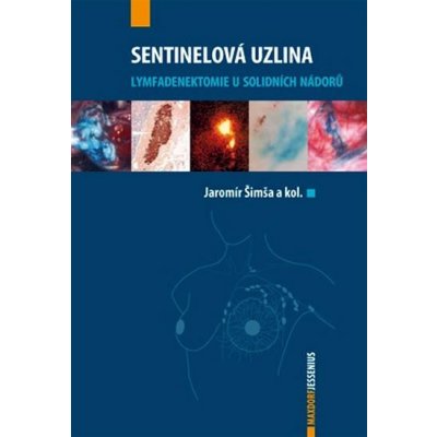 Sentinelová uzlina - Šimša Jaromír a kolektiv – Hledejceny.cz