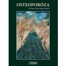 Osteoporóza - Juraj Payer, Zdenko Killinger