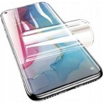 Ochranná fólie Hydrogel Huawei P30 Lite – Zboží Mobilmania