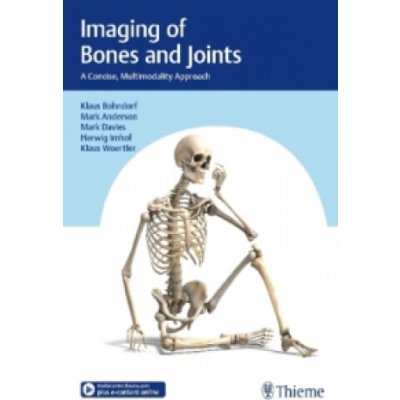 Imaging of Bones and Joints