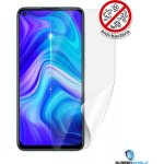 Ochranná fólie Screenshield Xiaomi Redmi Note 9 Pro - displej – Hledejceny.cz