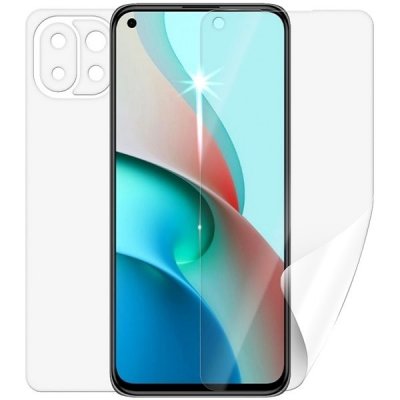 Ochranná fólie Screenshield pro XIAOMI Mi 11 Lite 5G - celé tělo – Zbozi.Blesk.cz