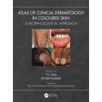 Atlas of Clinical Dermatology in Coloured Skin – Hledejceny.cz